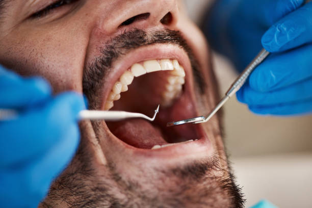 Best Emergency Cosmetic Dentistry in Effort, PA