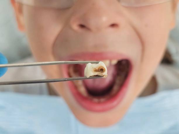 Best Urgent Dental Care for Toothache in Effort, PA